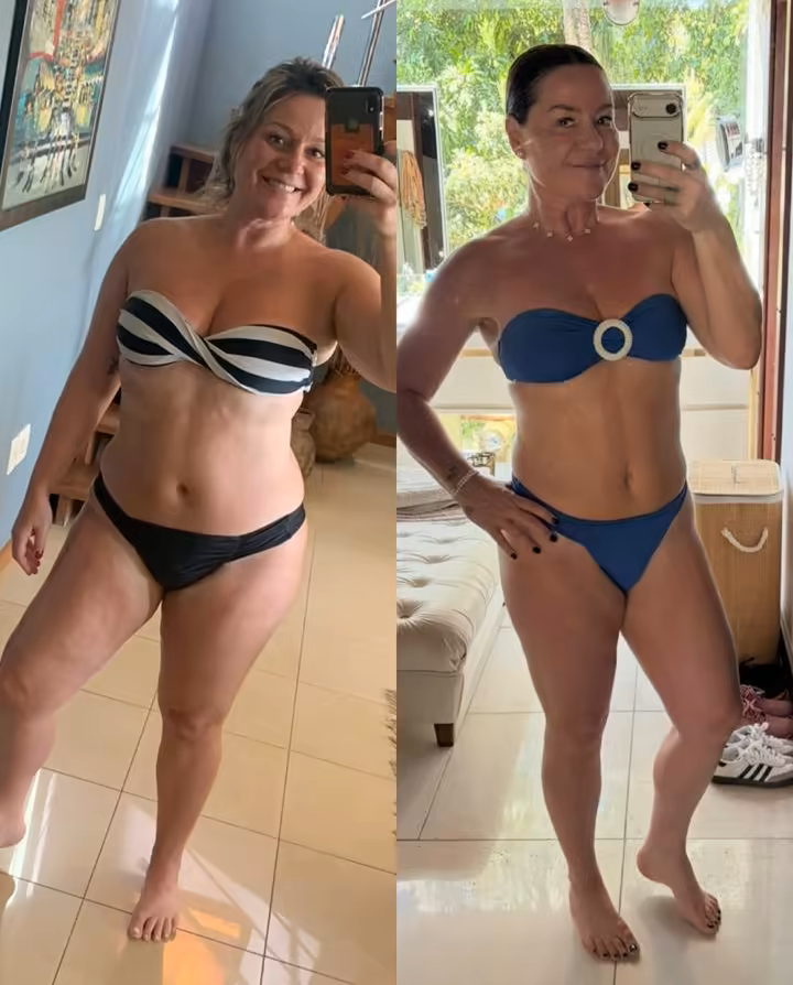 Dra. Vanessa antes e depois da transformação